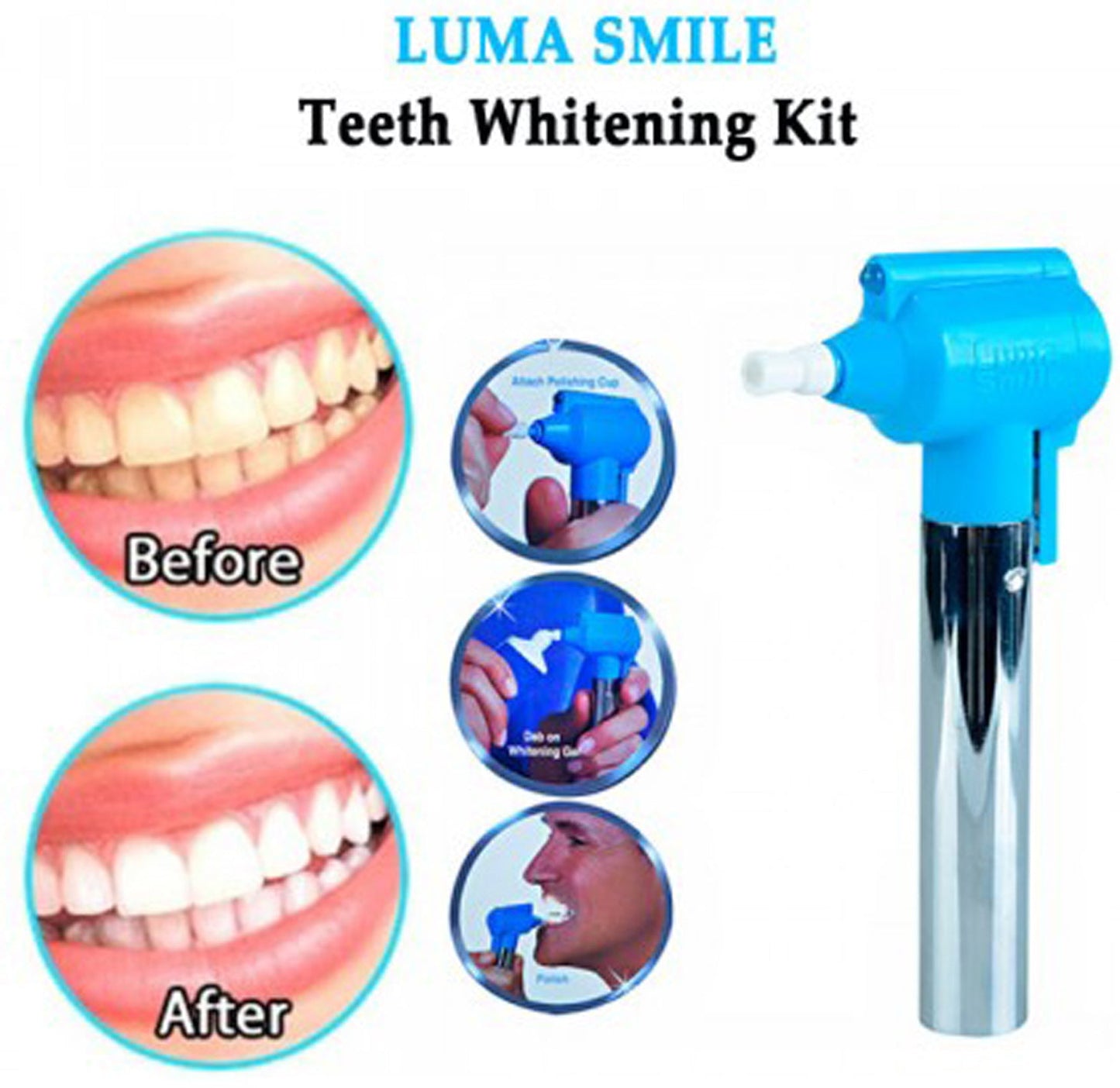 Unique Smile Tooth Polisher Cleaner and Whitening Kit. Teeth Whitening Kit