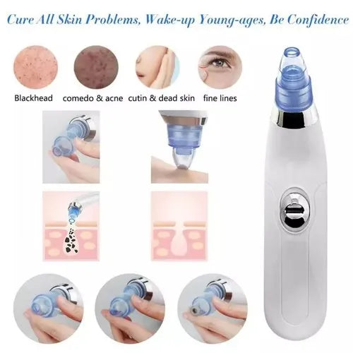 Professional Blackhead Remover Dermasuction Machine Battery Operated With 4 Nozzles